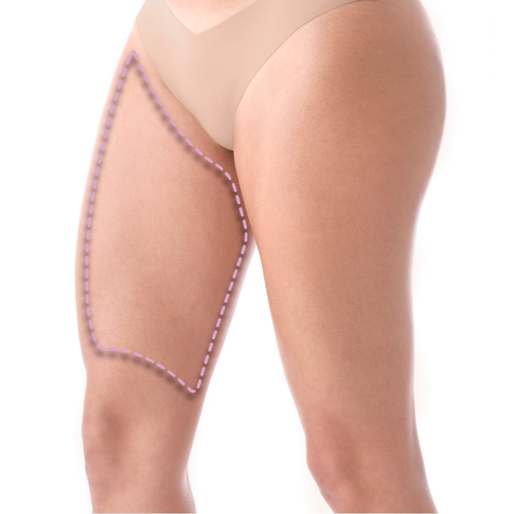 Medias piernas superior